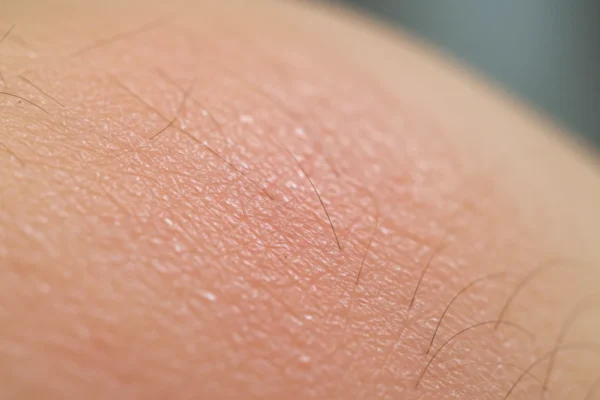 Rosacea Waxing: 5 Tips for 2026 Skin Safety