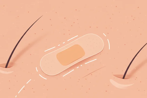 Skin Health: Patch Test Myths Debunked for 2026