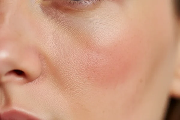Waxing Precautions: Sun Risks for Reactive Skin